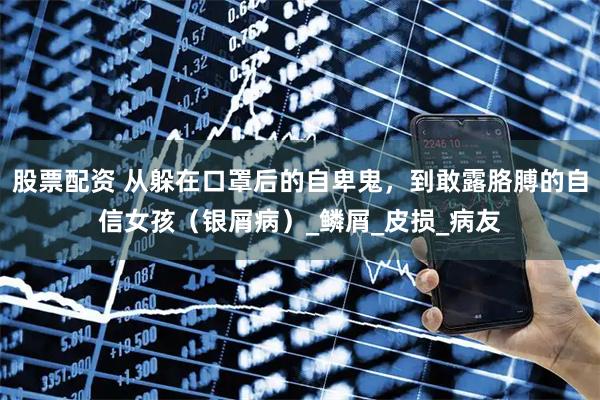 股票配资 从躲在口罩后的自卑鬼，到敢露胳膊的自信女孩（银屑病）_鳞屑_皮损_病友